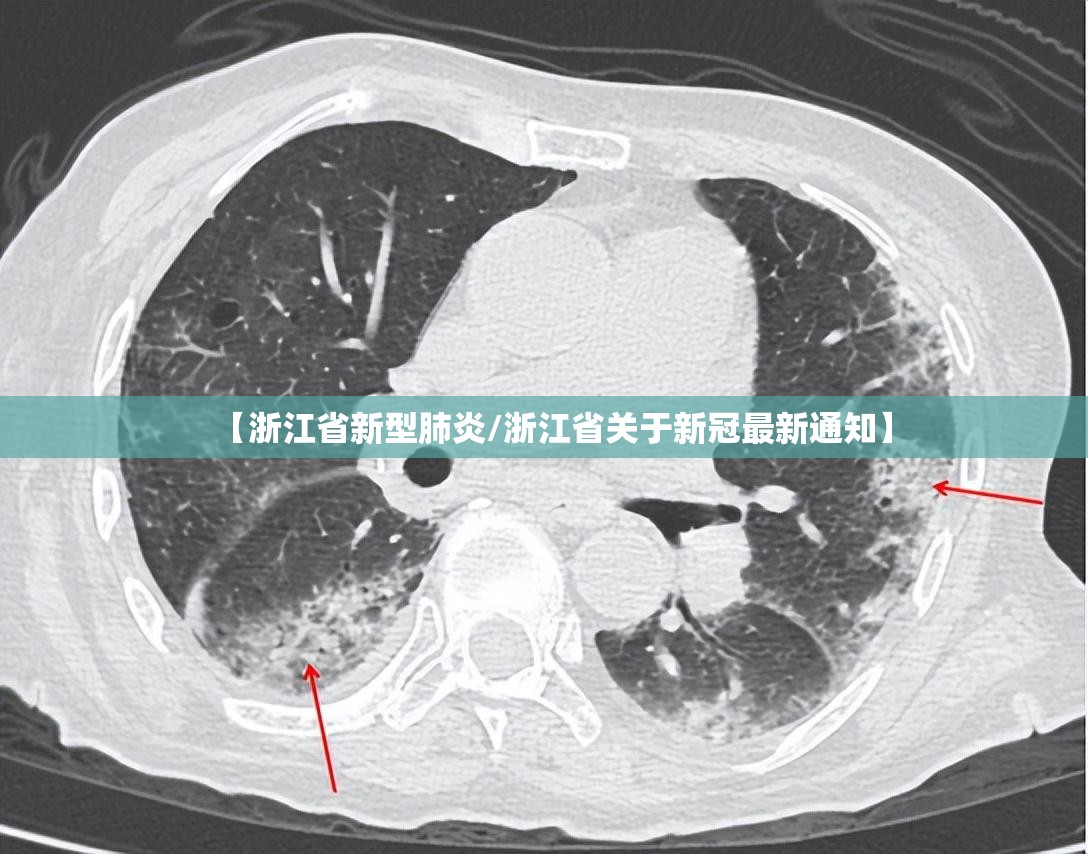 【浙江省新型肺炎/浙江省关于新冠最新通知】