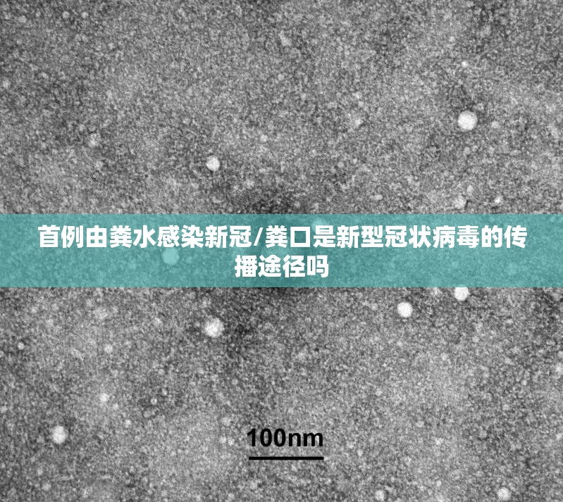 首例由粪水感染新冠/粪口是新型冠状病毒的传播途径吗