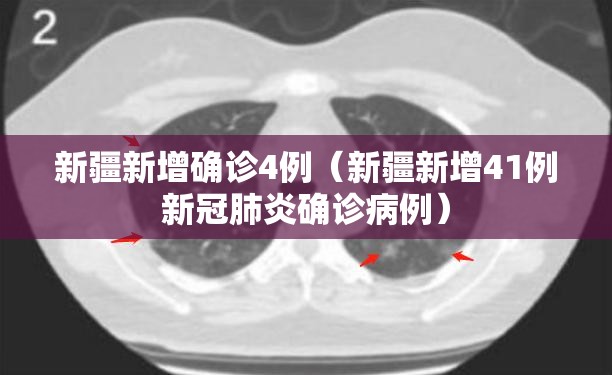 新疆新增确诊4例（新疆新增41例新冠肺炎确诊病例）