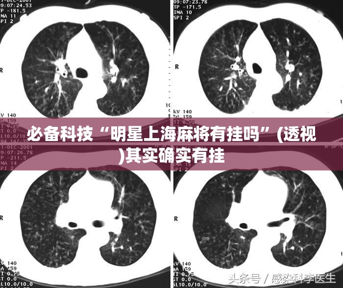 必备科技“明星上海麻将有挂吗”(透视)其实确实有挂