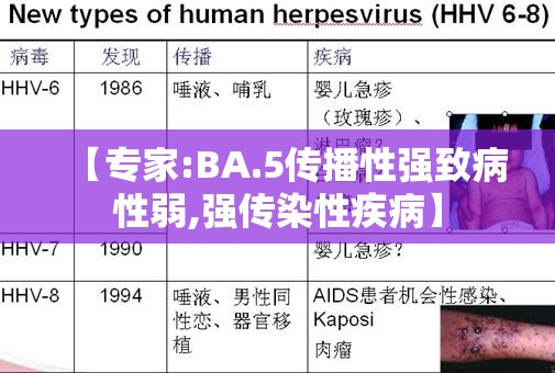 【专家:BA.5传播性强致病性弱,强传染性疾病】