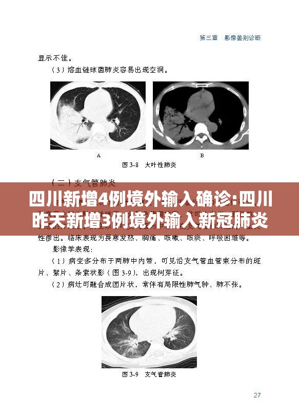 四川新增4例境外输入确诊:四川昨天新增3例境外输入新冠肺炎确诊病例 四川新增4例境外输入确诊:四川昨天新增3例境外输入新冠肺炎确诊病例