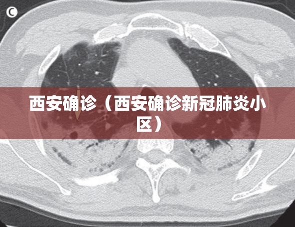 西安确诊（西安确诊新冠肺炎小区）