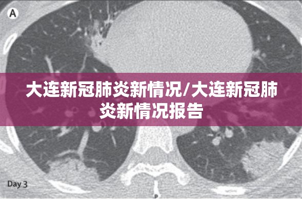 大连新冠肺炎新情况/大连新冠肺炎新情况报告 大连新冠肺炎新情况/大连新冠肺炎新情况报告