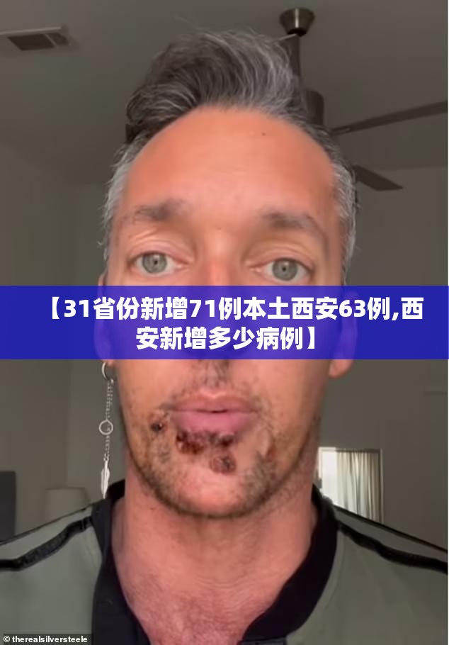 【31省份新增71例本土西安63例,西安新增多少病例】 【31省份新增71例本土西安63例,西安新增多少病例】