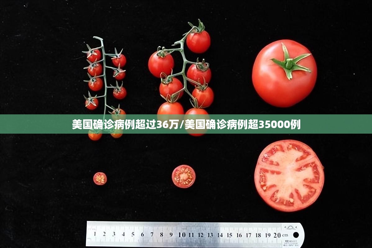 美国确诊病例超过36万/美国确诊病例超35000例