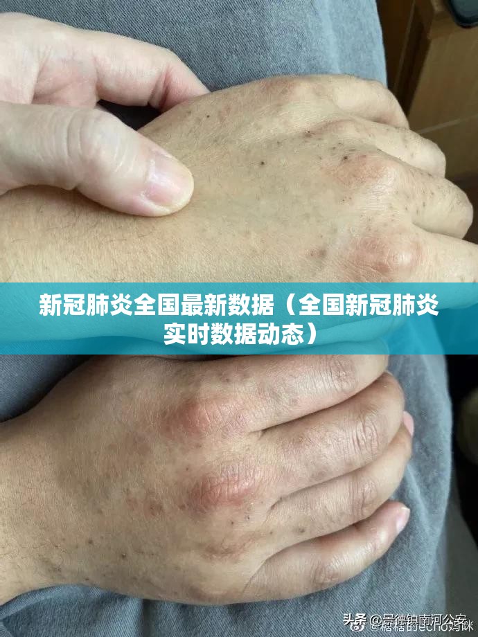 新冠肺炎全国最新数据(全国新冠肺炎实时数据动态) 新冠肺炎全国最新数据(全国新冠肺炎实时数据动态)