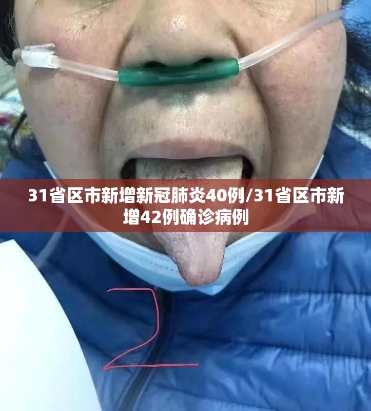 31省区市新增新冠肺炎40例/31省区市新增42例确诊病例