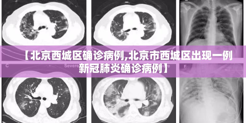 【北京西城区确诊病例,北京市西城区出现一例新冠肺炎确诊病例】