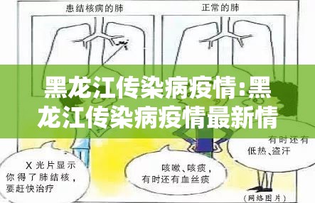 黑龙江传染病疫情:黑龙江传染病疫情最新情况 黑龙江传染病疫情:黑龙江传染病疫情最新情况