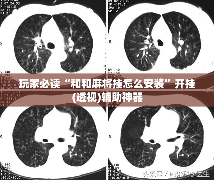 玩家必读“和和麻将挂怎么安装	”开挂(透视)辅助神器