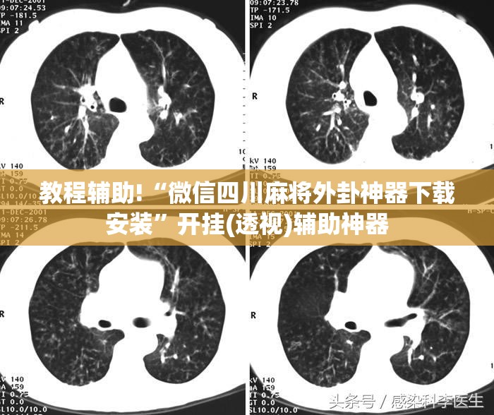 教程辅助!“微信四川麻将外卦神器下载安装”开挂(透视)辅助神器