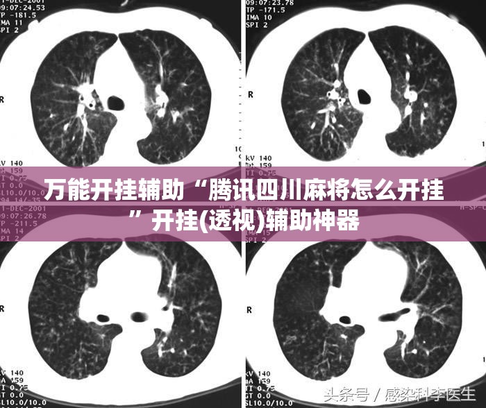 万能开挂辅助“腾讯四川麻将怎么开挂”开挂(透视)辅助神器