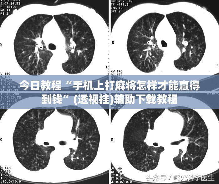今日教程“手机上打麻将怎样才能赢得到钱”(透视挂)辅助下载教程